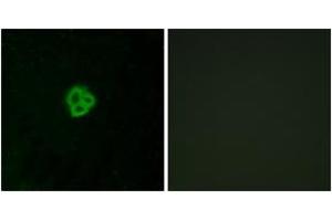 Immunofluorescence analysis of MCF7 cells, using AGTR1 Antibody. (Angiotensin II Type-1 Receptor anticorps  (AA 101-150))