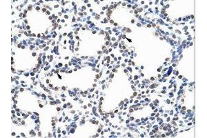 anti-Pumilio RNA Binding Family Member 3 (PUM3) (AA 61-110) antibody