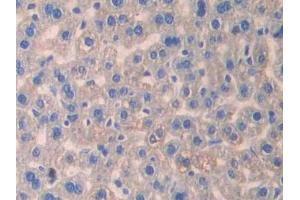 Used in DAB staining on fromalin fixed paraffin- embedded stomach tissue (IL13 Receptor alpha 1 anticorps  (AA 28-171))