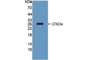 Western Blot; Sample: Recombinant SNAP25, Human.