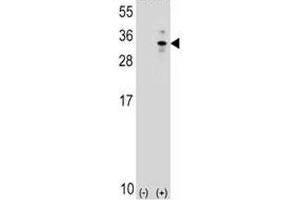 Western blot analysis of XBP1 antibody and 293 cell lysate (2 ug/lane) either nontransfected (Lane 1) or transiently transfected (2) with the human gene. (XBP1 anticorps  (AA 62-91))