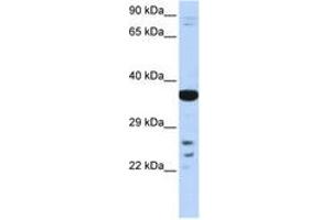 Image no. 1 for anti-Visual System Homeobox 1 (VSX1) (AA 108-157) antibody (ABIN6742618) (VSX1 anticorps  (AA 108-157))