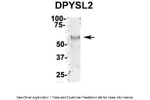 IP Suggested Anti-DPYSL2 Antibody Positive Control: NT2 CELL/BRAIN TISSUE (DPYSL2 anticorps  (Middle Region))