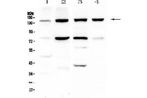Western blot analysis of Integrin alpha 5 using anti-Integrin alpha 5 antibody . (ITGA5 anticorps  (AA 42-263))