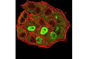 Immunofluorescence analysis of Hela cells using ESR1 mouse mAb (green).