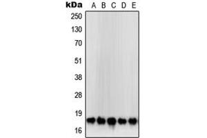 Western blot analysis of SOD1 expression in HeLa (A), MCF7 (B), Jurkat (C), HepG2 (D), DU145 (E) whole cell lysates.