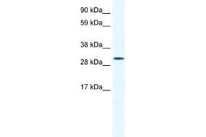 Human Jurkat; WB Suggested Anti-SOX12 Antibody Titration: 0. (SOX12 anticorps  (C-Term))