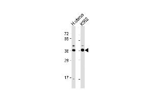 Western Blot at 1:1000 dilution Lane 1: human uterus lysate Lane 2: K562 whole cell lysate Lysates/proteins at 20 ug per lane. (OR52H1 anticorps  (C-Term))
