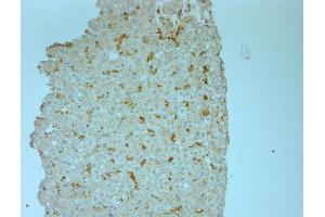 human liver-3 (ERK1/2 anticorps  (pThr202, pTyr204))