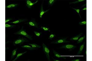 Immunofluorescence of purified MaxPab antibody to CUGBP1 on HeLa cell. (CELF1 anticorps  (AA 1-483))