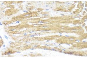 Immunohistochemistry of paraffin-embedded Rat heart using ASMT Polyclonal Antibody at dilution of 1:100 (40x lens). (ASMT anticorps)