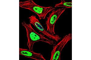 Fluorescent confocal image of Hela cell stained with EWSR1 Antibody . (EWSR1 anticorps  (C-Term))