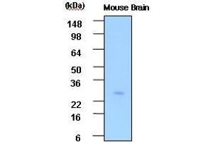 The extracts of Mouse brain(30 ug) were resolved by SDS-PAGE, transferred to PVDF membrane and probed with anti-human PSP (1:1,000). (STXBP3 anticorps  (AA 1-225))