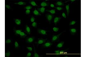 Immunofluorescence of monoclonal antibody to SURB7 on HeLa cell. (MED21 anticorps  (AA 1-144))