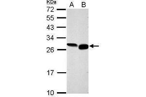 WB Image Sample (30 ug of whole cell lysate) A: NIH-3T3 B: BCL-1 12% SDS PAGE antibody diluted at 1:1000 (GRB2 anticorps  (C-Term))