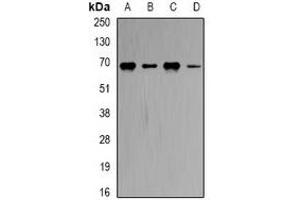 Western blot analysis of CBS expression in Hela (A), MCF7 (B), Romas (C), mouse brain (D) whole cell lysates. (CBS anticorps)