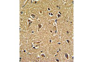 Immunohistochemistry (IHC) image for anti-Calcium Channel, Voltage-Dependent, gamma Subunit 5 (CACNG5) antibody (ABIN3002719) (CACNG5 anticorps)