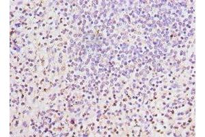 Immunohistochemistry of paraffin-embedded human spleen tissue using ABIN7158655 at dilution of 1:100 (LSP1 anticorps  (AA 1-339))