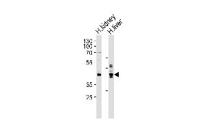 Western blot analysis of lysates from human kidney and liver tissue lysate (from left to right), using SEPT9 Antibody (C-term) (ABIN390155 and ABIN2840654).