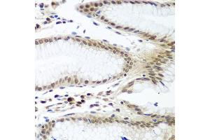 Immunohistochemistry of paraffin-embedded human stomach using PTTG1 antibody. (PTTG1 anticorps)