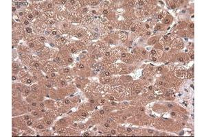 Image no. 4 for anti-Myc Proto-Oncogene protein (MYC) antibody (ABIN1497012) (c-MYC anticorps)