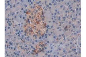 Detection of ROS1 in Human Pancreas Tissue using Polyclonal Antibody to C-Ros Oncogene 1, Receptor Tyrosine Kinase (ROS1)