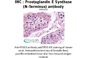 Image no. 1 for anti-Prostaglandin E Synthase (PTGES) (N-Term) antibody (ABIN1738425) (Prostaglandin E Synthase anticorps  (N-Term))