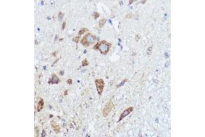 Immunohistochemistry of paraffin-embedded mouse spinal cord using  Rabbit pAb (ABIN7265359) at dilution of 1:50 (40x lens).