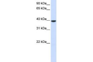 Human Muscle; WB Suggested Anti-AGPAT5 Antibody Titration: 0. (AGPAT5 anticorps  (N-Term))