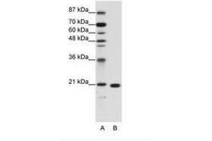 Image no. 1 for anti-Ribosomal Protein L9 (RPL9) (C-Term) antibody (ABIN203024) (RPL9 anticorps  (C-Term))