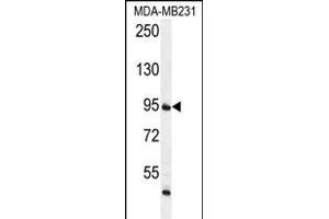 FTSJ3 Antibody (Center) (ABIN655995 and ABIN2845377) western blot analysis in MDA-M cell line lysates (35 μg/lane). (FTSJ3 anticorps  (AA 616-646))