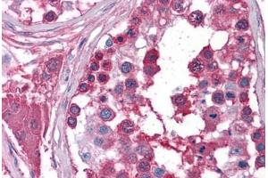 Human Testis: Formalin-Fixed, Paraffin-Embedded (FFPE)