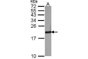 WB Image Sample (30 ug of whole cell lysate) A: Hela 15% SDS PAGE Superoxide Dismutase 1 antibody antibody diluted at 1:1000 (SOD1 anticorps)