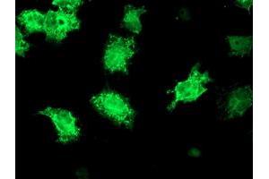 Anti-KATNB1 mouse monoclonal antibody (ABIN2455204) immunofluorescent staining of COS7 cells transiently transfected by pCMV6-ENTRY KATNB1 (RC201852). (KATNB1 anticorps)