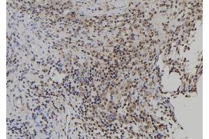 ABIN6279902 at 1/100 staining Human spleen tissue by IHC-P. (USP49 anticorps  (Internal Region))