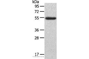 Western blot analysis of Human ovarian cancer tissue, using LAG3 Polyclonal Antibody at dilution of 1:148 (LAG3 anticorps)