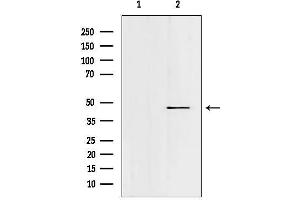 anti-Forkhead Box N2 (FOXN2) (C-Term) antibody