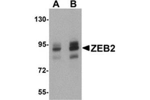 Western blot analysis of ZEB2 in Jurkat cell lysate with ZEB2 antibody at (A) 1 and (B) 2 μg/ml. (ZEB2 anticorps  (C-Term))