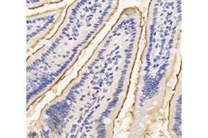 Immunohistochemistry analysis of paraffin-embedded mouse small intestine using ASAH2 (ABIN7074749) at dilution of 1:4200 (ASAH2 anticorps)