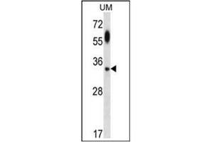 Western blot analysis using ATG5 Antibody  in UM cell line lysates (35ug/lane). (ATG5 anticorps)