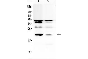Western blot analysis of IL11 using anti-IL11 antibody . (IL-11 anticorps  (AA 25-199))