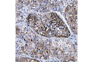 IHC analysis of Rab4/RAB4A using anti-Rab4/RAB4A antibody (ABIN7599733). (Rab4 anticorps  (AA 110-216))
