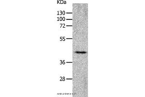 Western blot analysis of Mouse heart tissue, using CHRFAM7A Polyclonal Antibody at dilution of 1:700 (CHRNA7 anticorps)