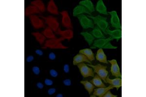 ABIN6258574 and ABIN6275343 staining Hela cells(45 min of heat-shock) by IF/ICC. (DECR2 anticorps  (Internal Region))