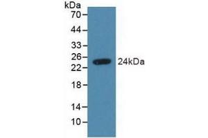 Detection of Recombinant SDC4, Human using Polyclonal Antibody to Syndecan 4 (SDC4) (SDC4 anticorps  (AA 18-145))