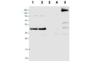 Western blot analysis of Lane 1: RT-4, Lane 2: U-251 MG, Lane 3: Human Plasma, Lane 4: Liver, Lane 5: Tonsil with CCDC94 polyclonal antibody  at 1:100-1:250 dilution. (CCDC94 anticorps)