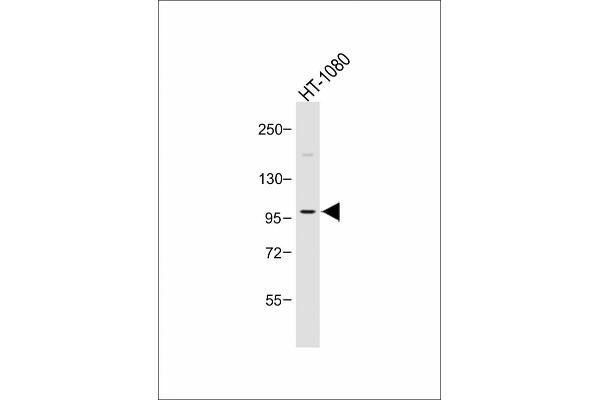 PIK3CD anticorps  (C-Term)