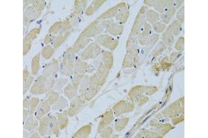 Immunohistochemistry of paraffin-embedded Rat heart using CA3 Polyclonal Antibody at dilution of 1:200 (40x lens). (CA3 anticorps)