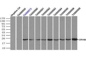 Image no. 2 for anti-Crystallin, alpha B (CRYAB) antibody (ABIN1497645) (CRYAB anticorps)