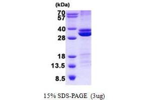 Image no. 1 for Ras Association (RalGDS/AF-6) Domain Family Member 3 (RASSF3) protein (His tag) (ABIN1098778) (RASSF3 Protein (His tag))